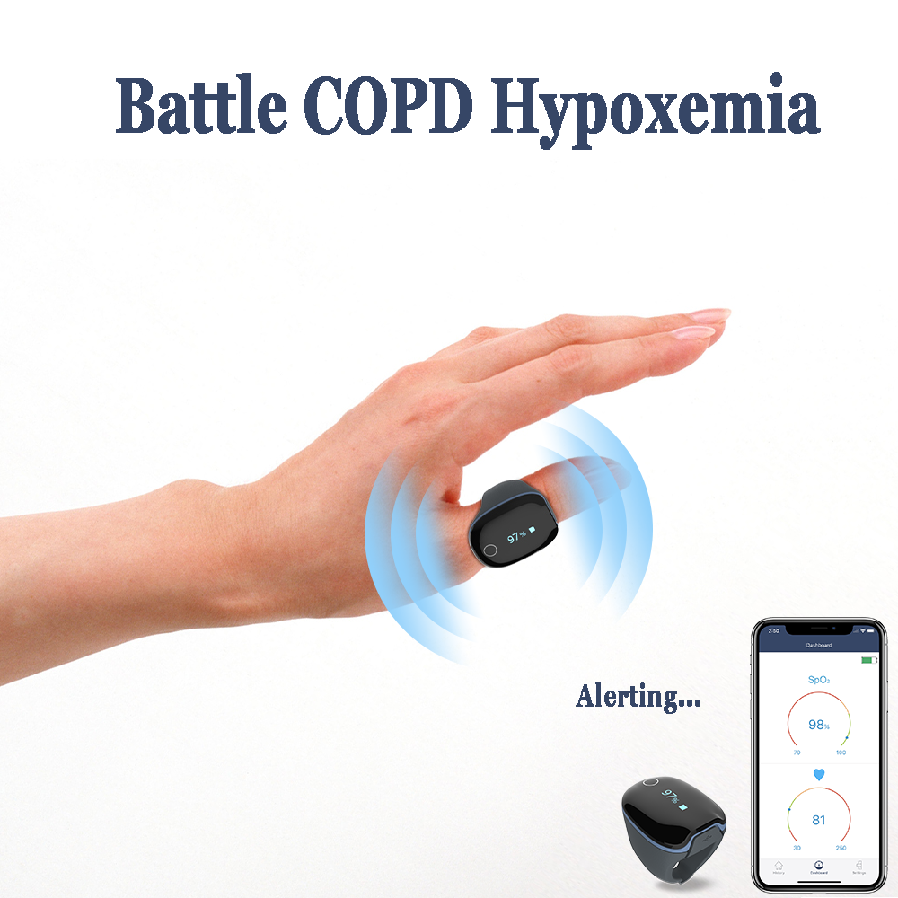 O2ring - Continuous Ring Oxygen Monitor gallery image