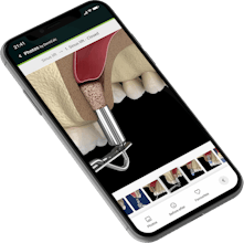 DentiCalc gallery image