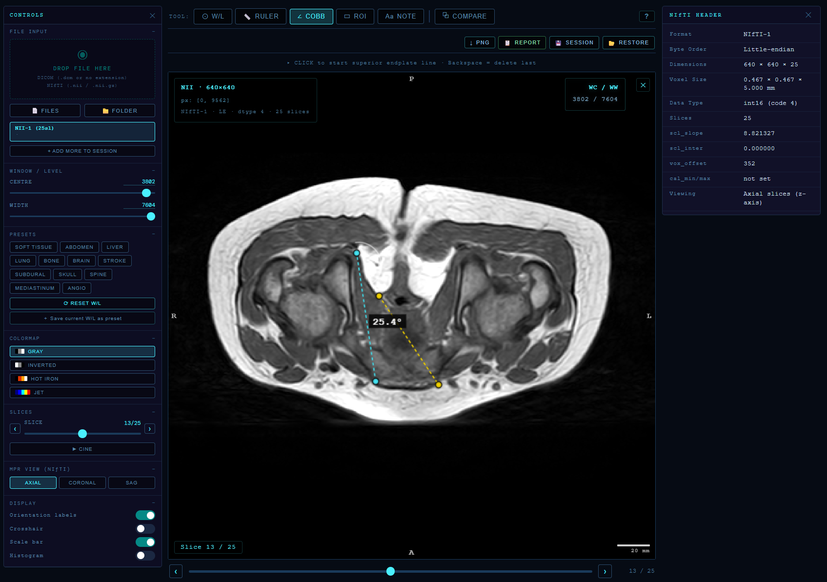 Scan Instant gallery image