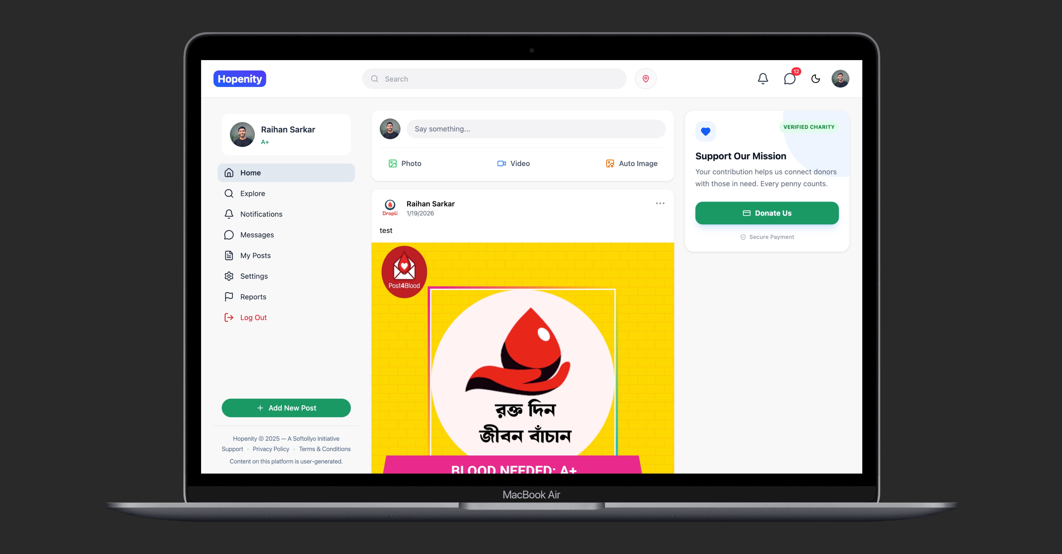 Hopenity - Main product screenshot demonstrating key features and user interface