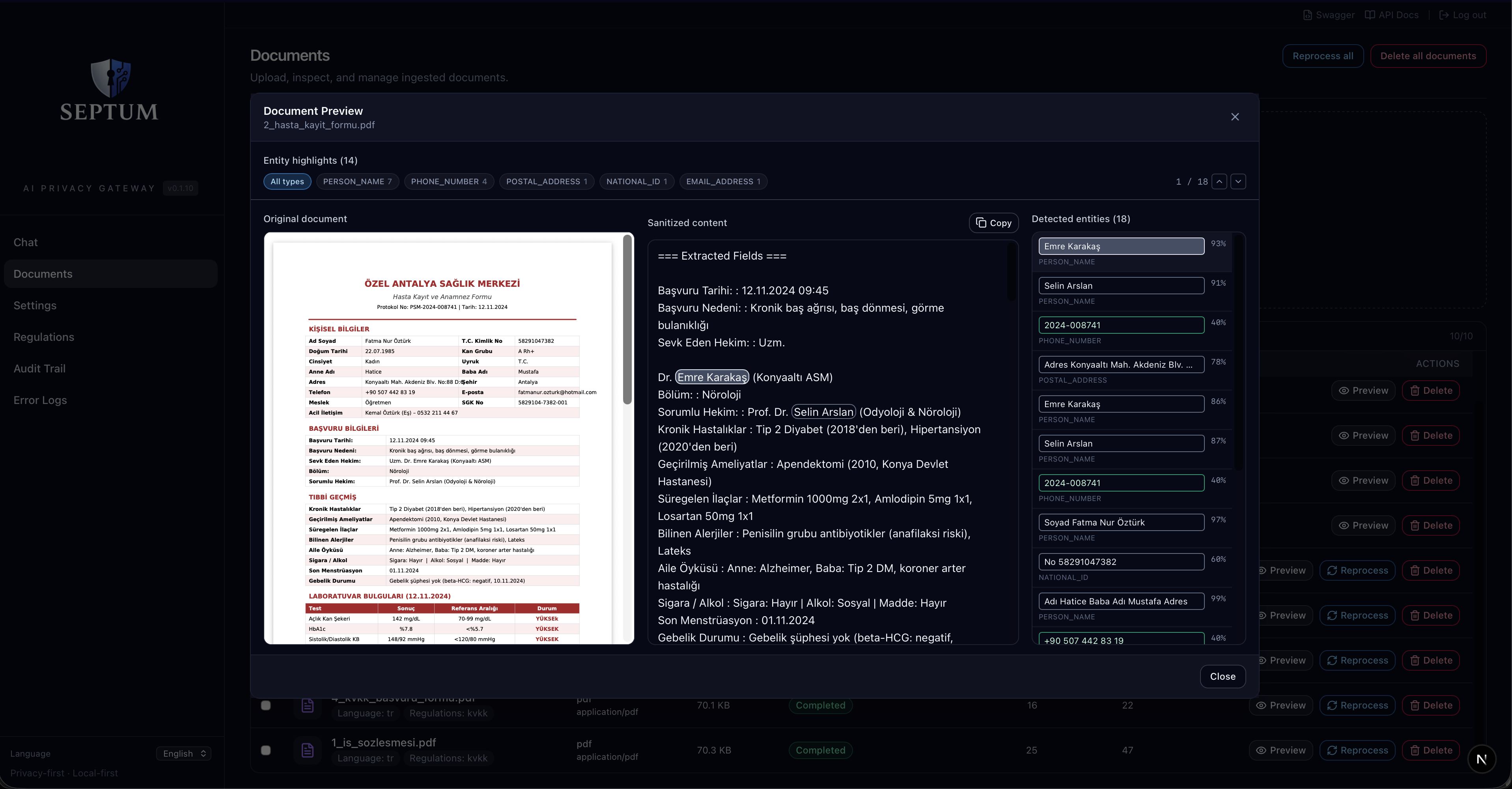 Septum gallery image