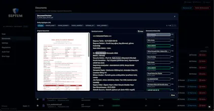 Septum gallery image