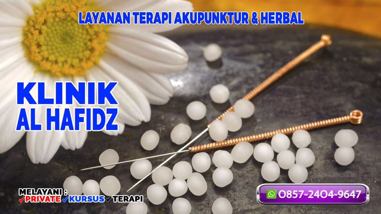 Terapi Pengobatan Akupunktur Purwakarta