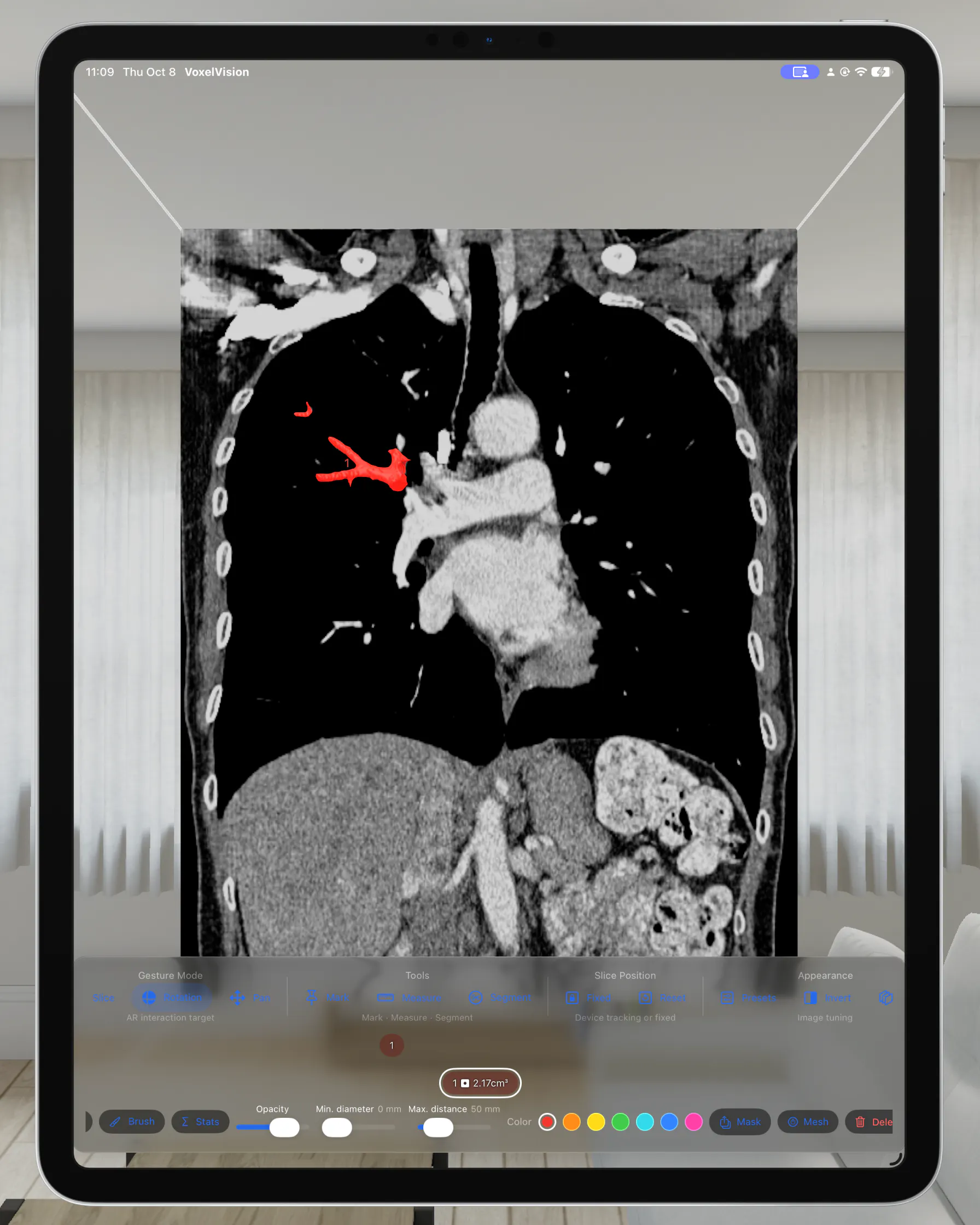 VoxelVision - DICOM Viewer gallery image