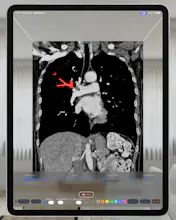 VoxelVision - DICOM Viewer gallery image