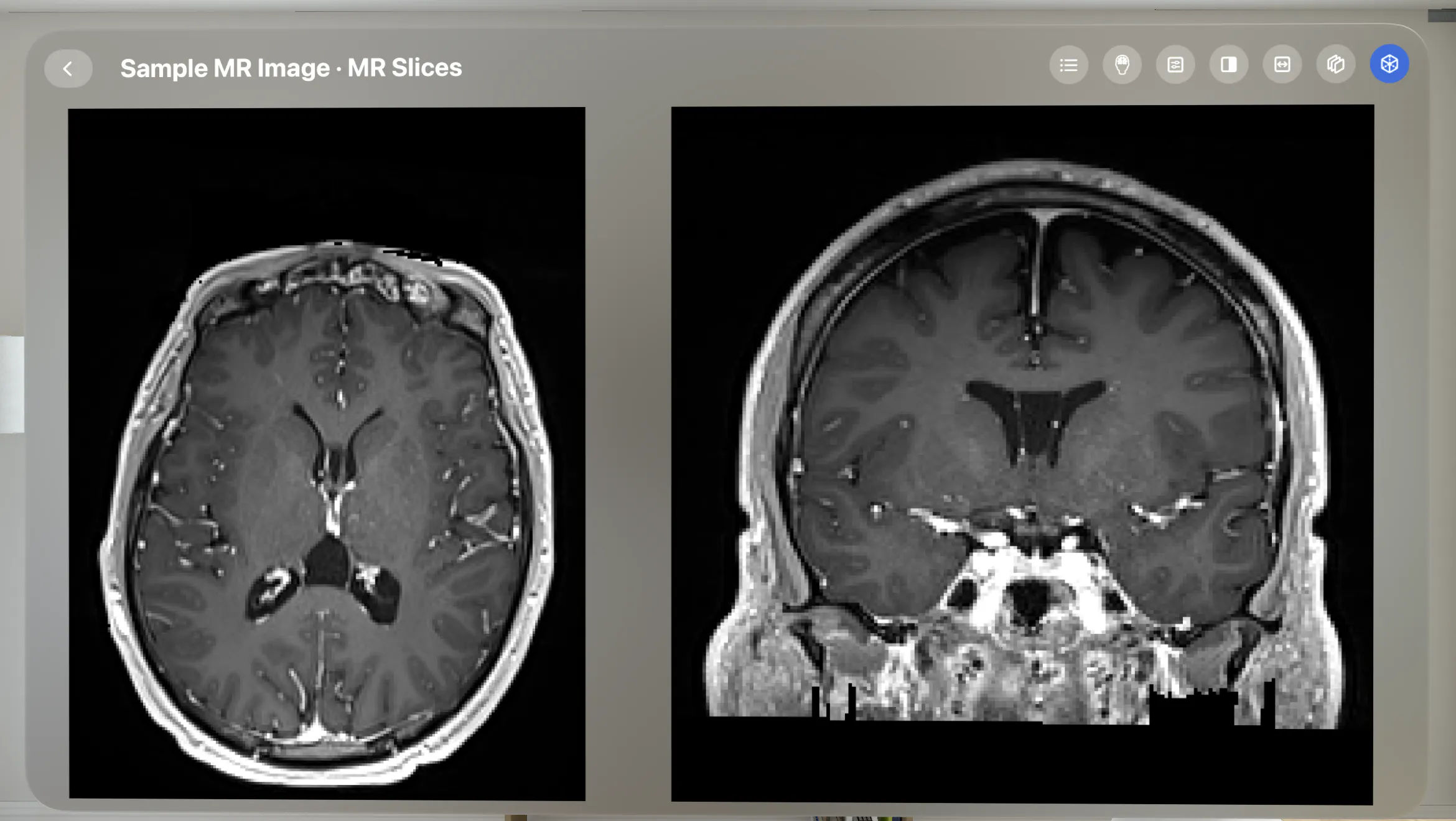 VoxelVision - DICOM Viewer gallery image