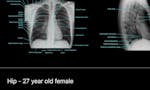 X-Rays: Atlas of Human Anatomy image