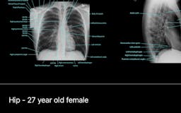 X-Rays: Atlas of Human Anatomy media 1