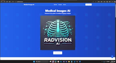 RadVision AI gallery image