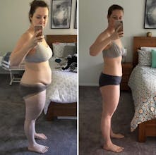 Weight Loss gallery image