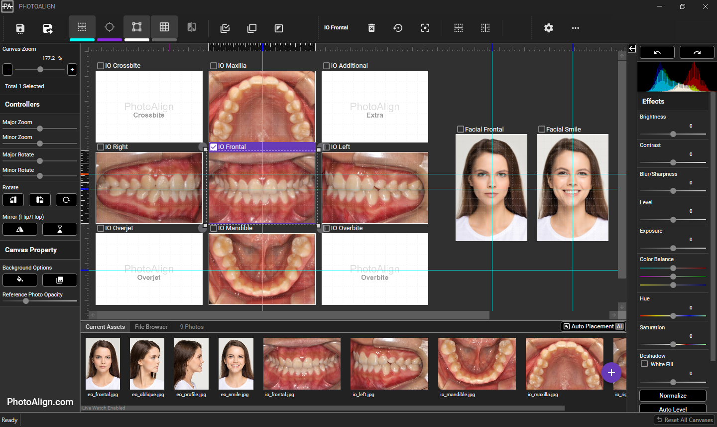 وسائط Photoalign Studio - برمجيات تحرير الصور وإدارة الأسنان السريرية 2