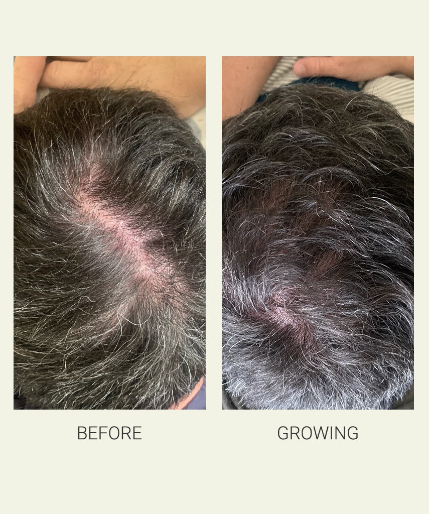 Activating Serum gallery image