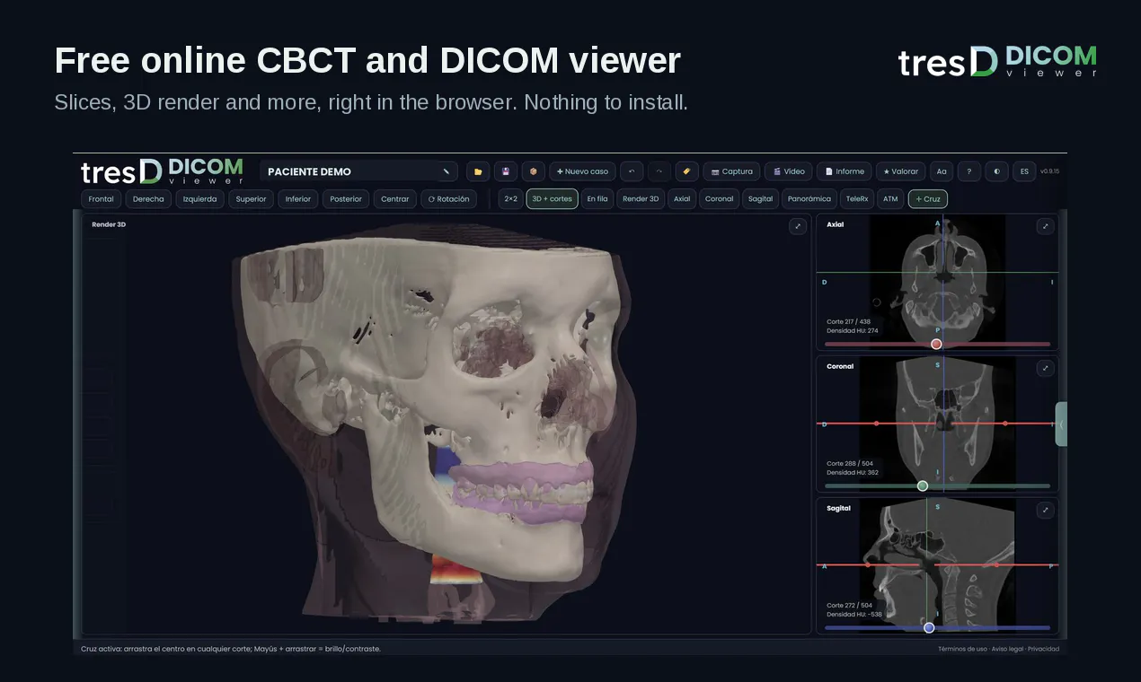 tresD DICOM gallery image