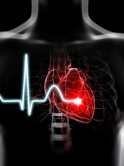 Zoll AED Plus Semi Automatic gallery image