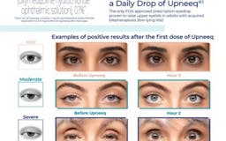 UPNEEQ – Eye Drop media 2