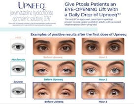 UPNEEQ – Eye Drop gallery image