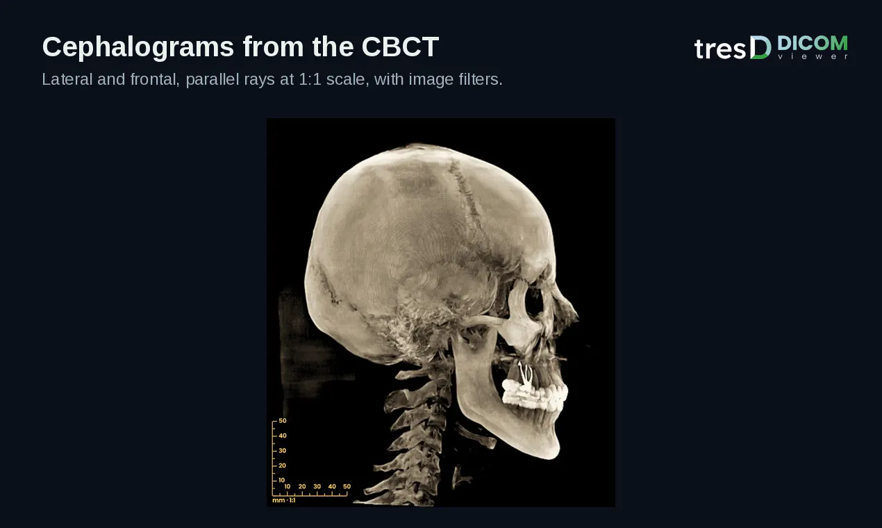 tresD DICOM gallery image