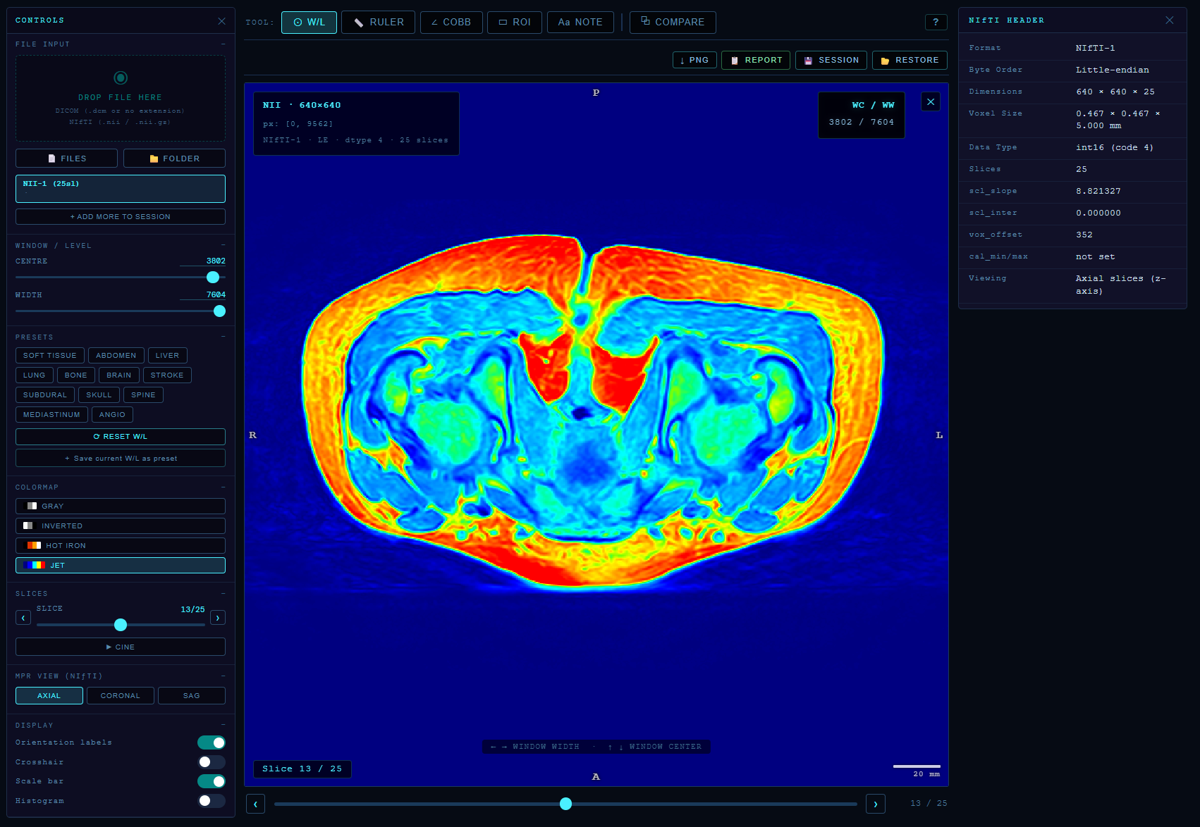 Scan Instant gallery image