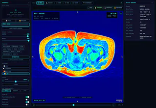 Scan Instant gallery image