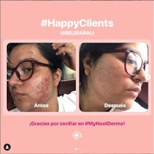 My NextDerma gallery image