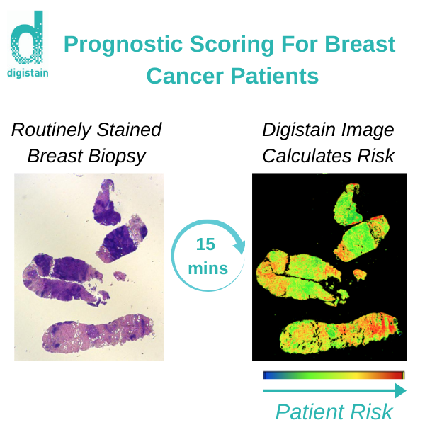 Digistain Prognostic Scoring gallery image