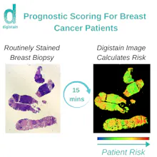 Digistain Prognostic Scoring gallery image
