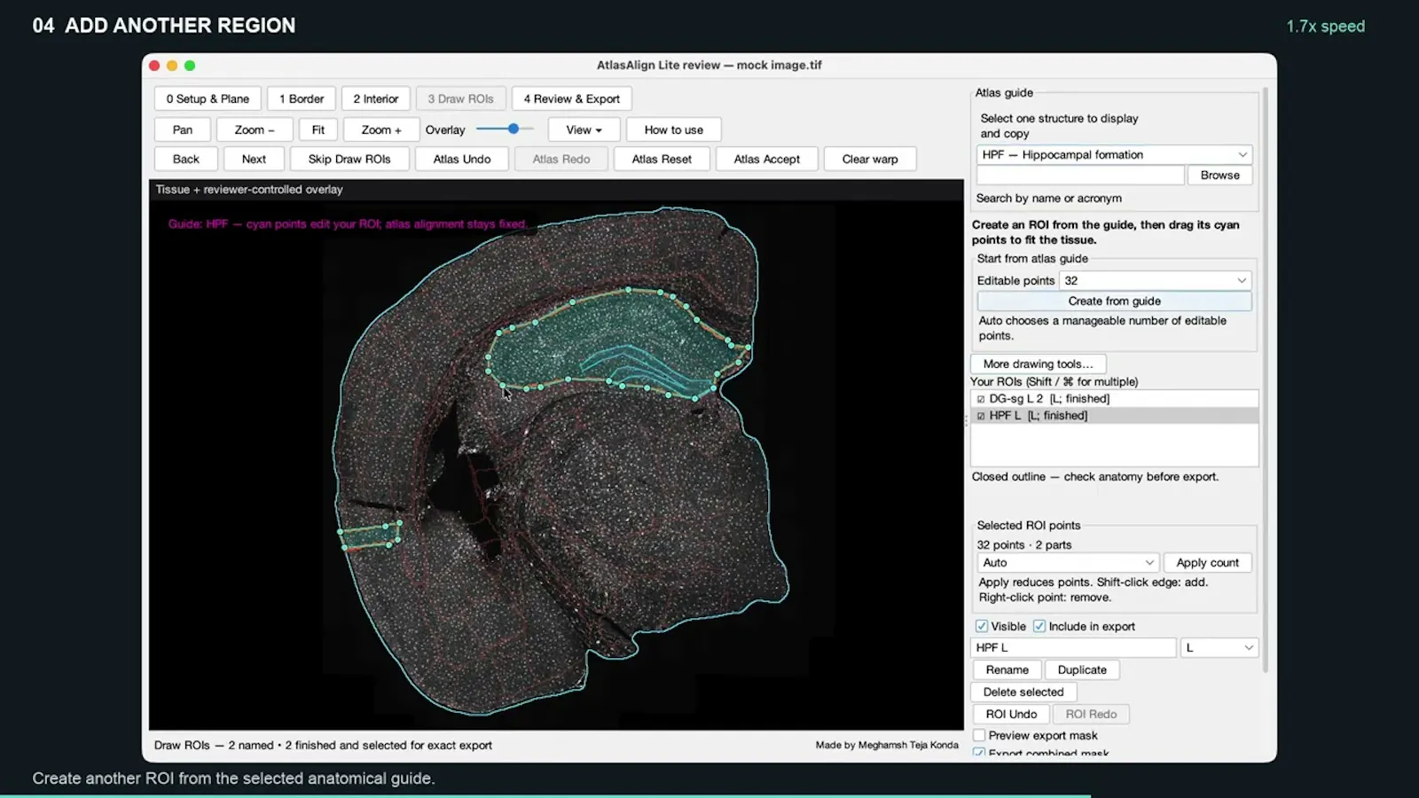 AtlasAlign screenshot 1 (video preview)