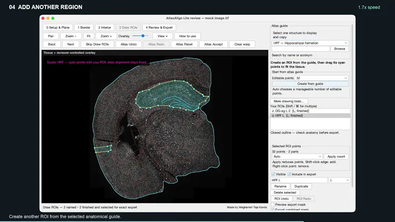 AtlasAlign screenshot 1 (video preview)