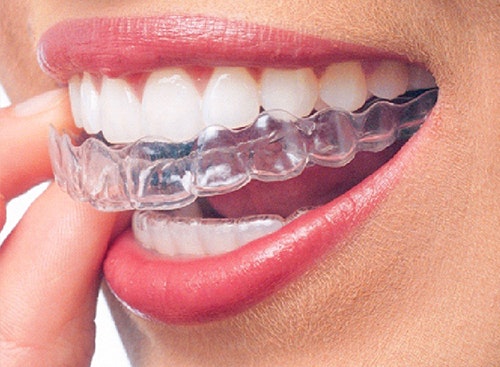 Dentist in Parramatta | MySmileDoctors  gallery image