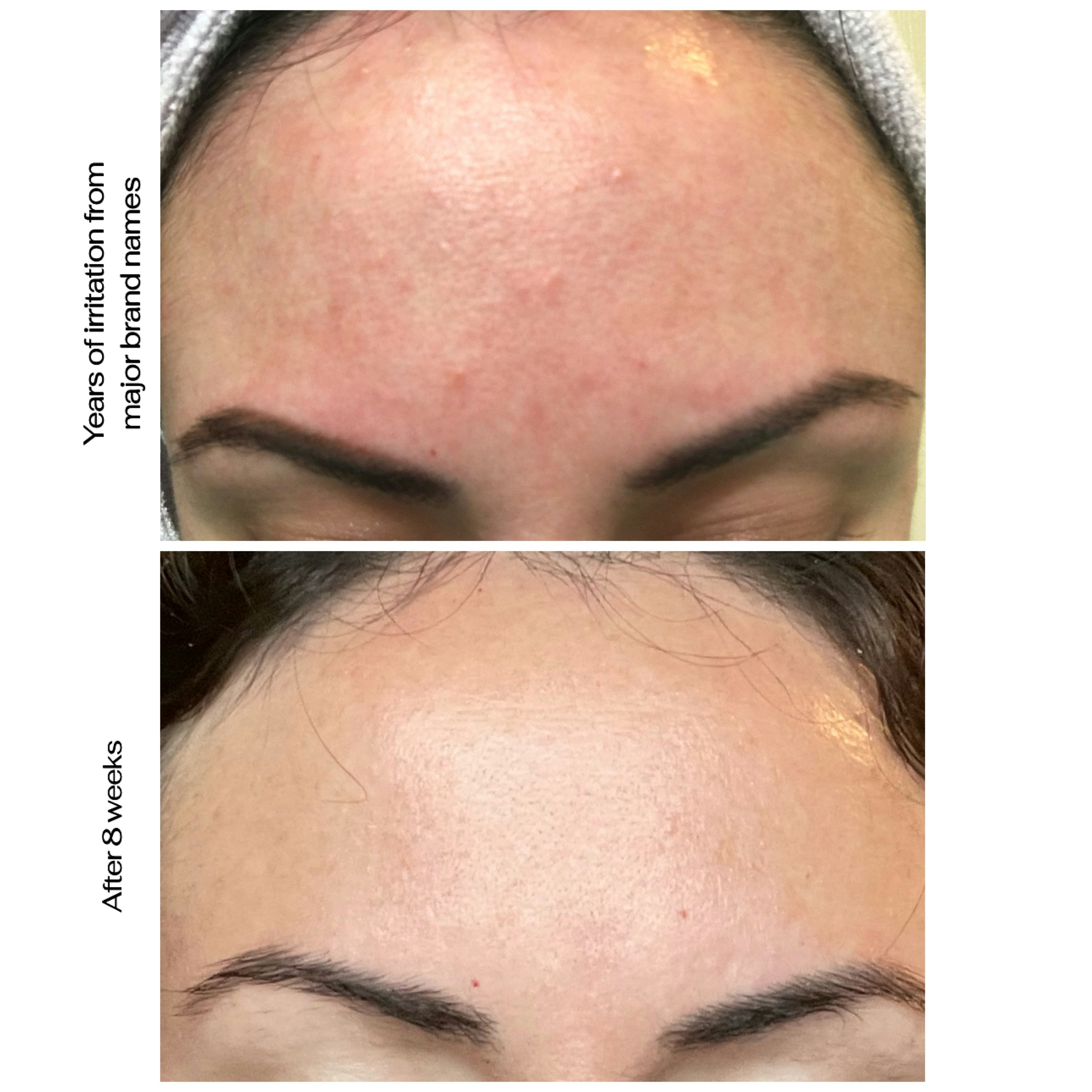 Mídia 3 de Finalmente tudo natural - Óleo de face revitalizante premiado