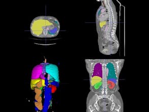 Intelec AI V4 gallery image