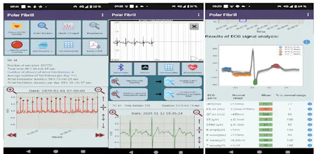 Polar H10 Fibrillation Search gallery image
