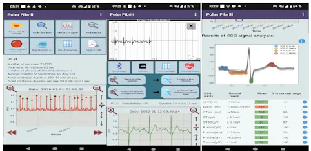 Polar H10 Fibrillation Search gallery image