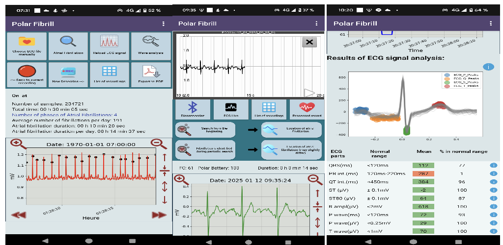 Polar H10 Fibrillation Search - Main product screenshot demonstrating key features and user interface