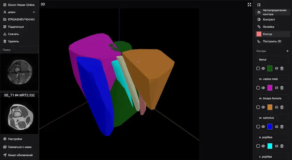 Dicom Viewer Online media 2