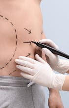 Liposuction in Lahore gallery image