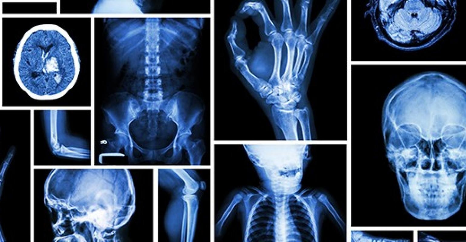 Software de relatório de radiologia