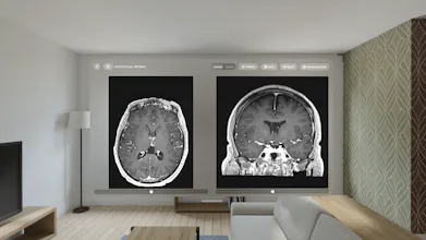 VoxelVision - DICOM Viewer gallery image