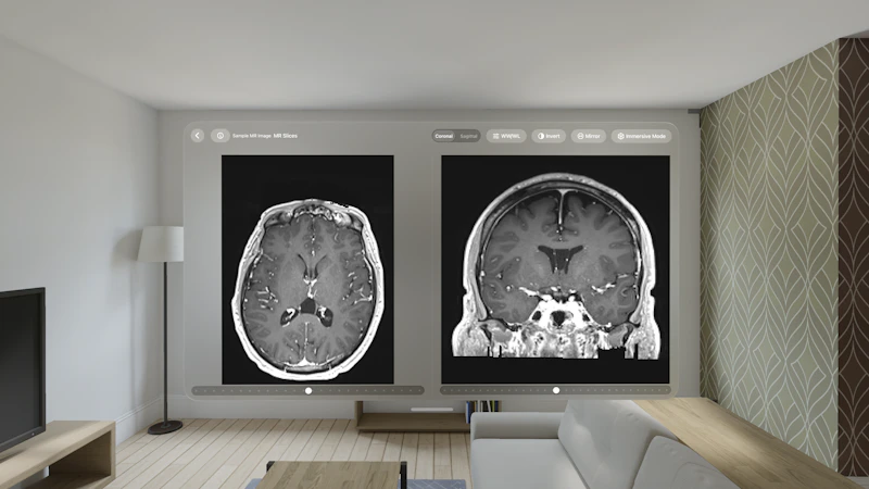 VoxelVision - DICOM Viewer screenshot 3