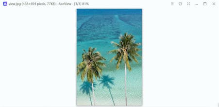 AceView gallery image