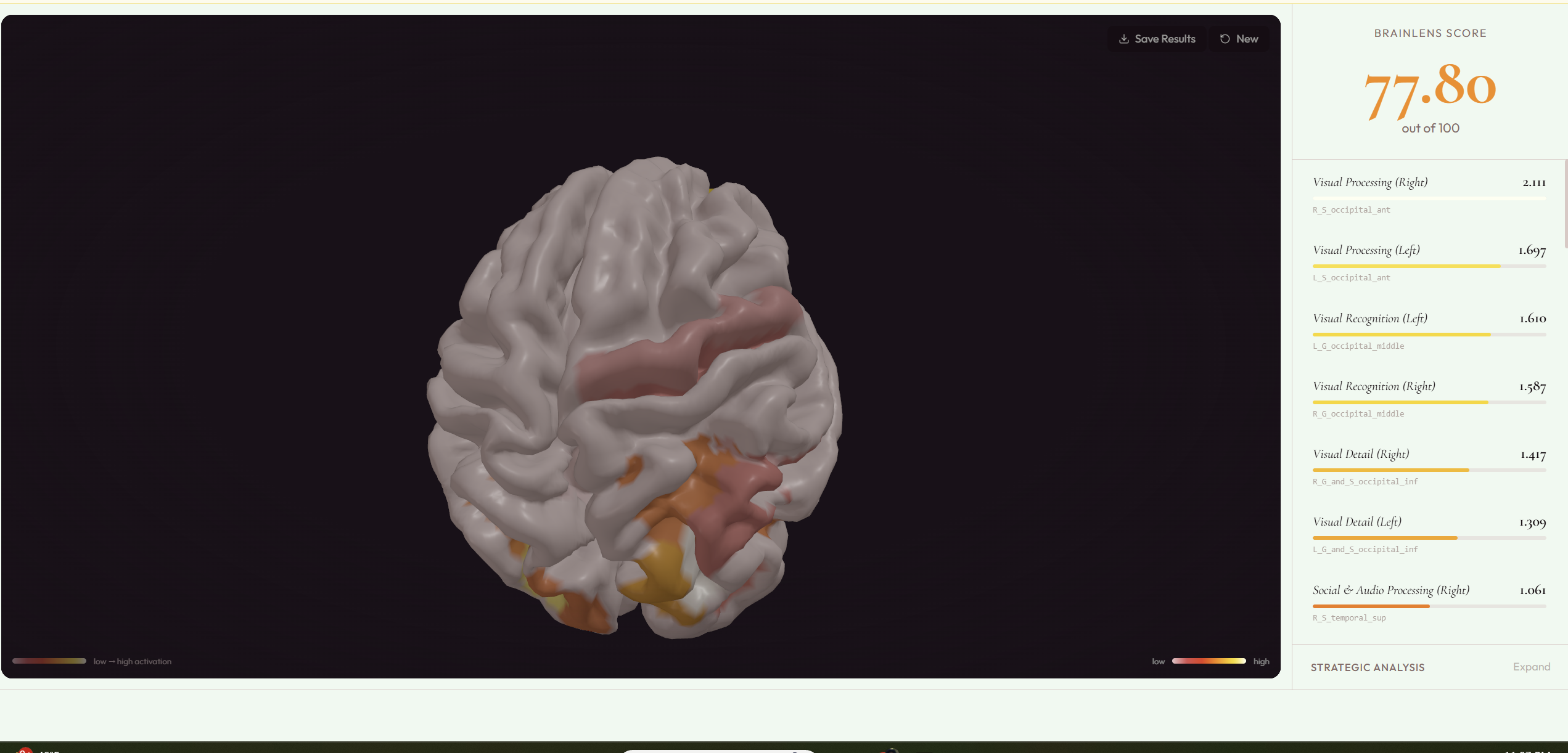 BrainLens gallery image