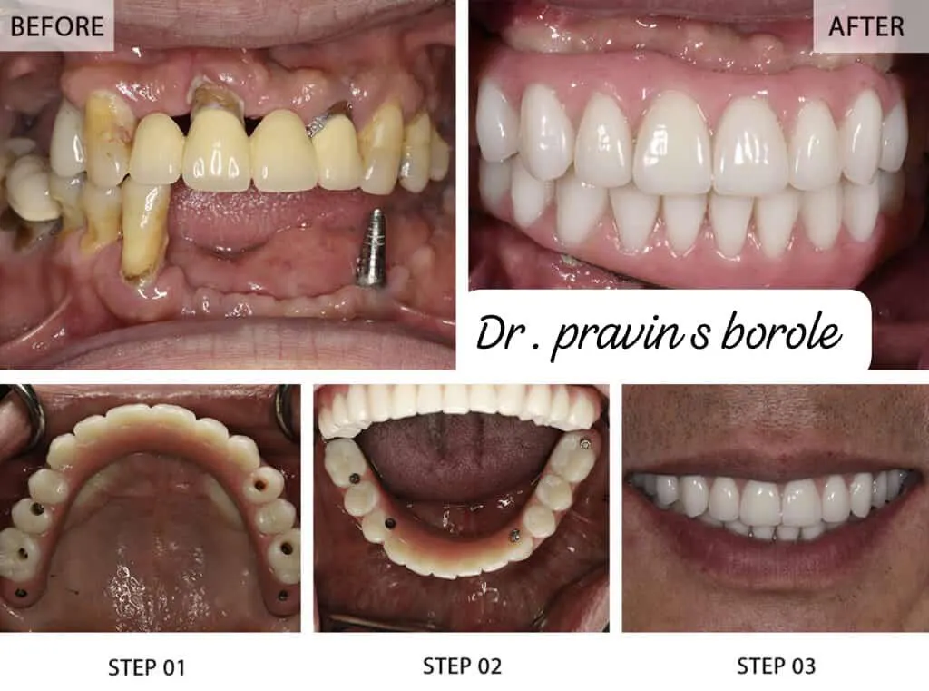 Anand Dental clinic & implant center gallery image