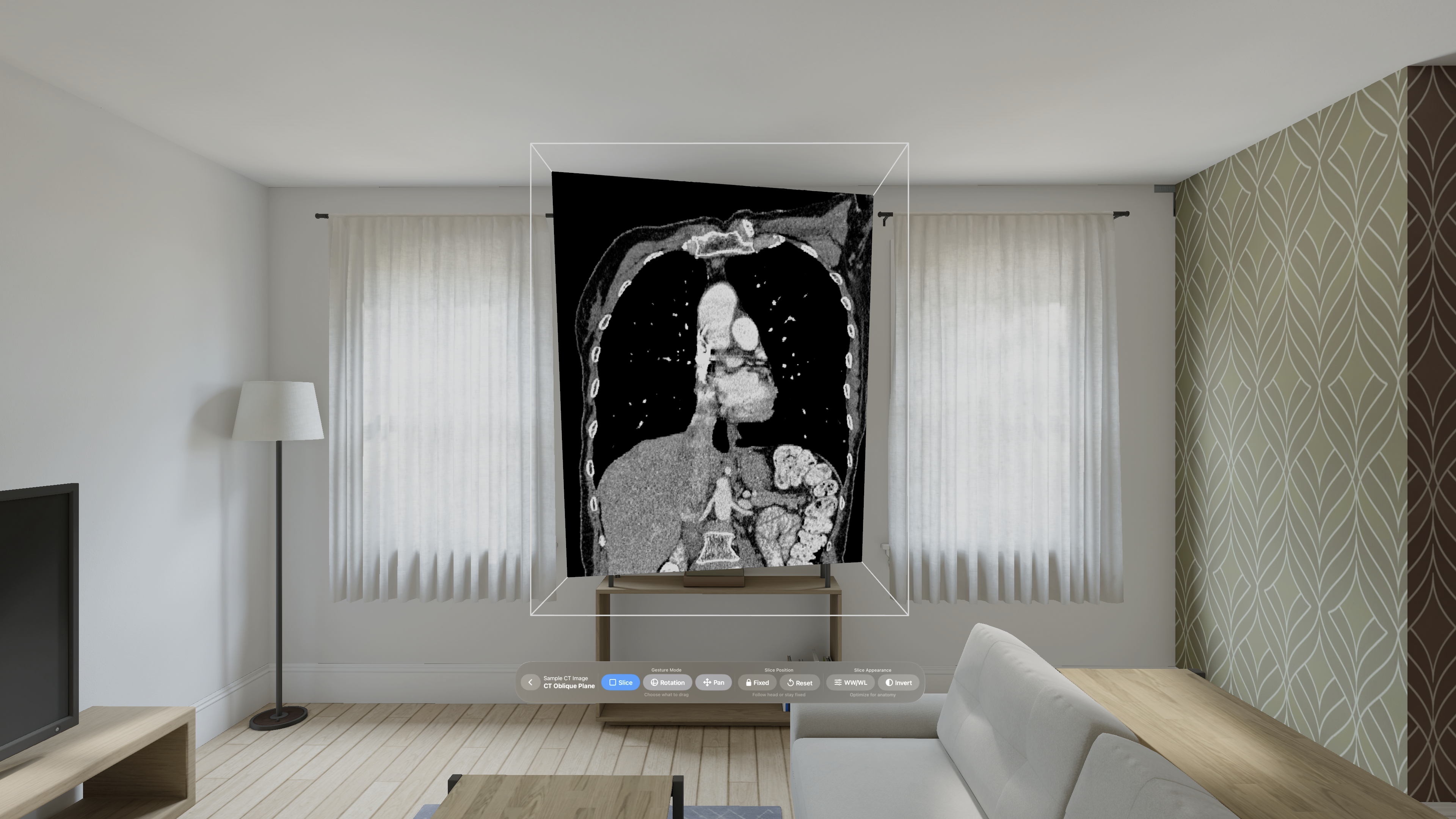 VoxelVision - DICOM Viewer gallery image