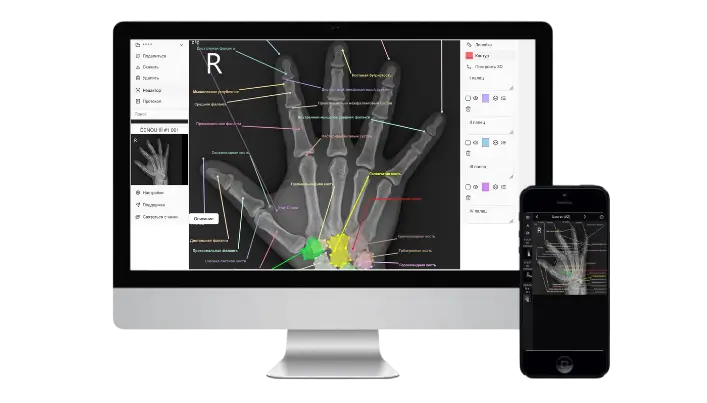 Dicom Viewer Online media 1