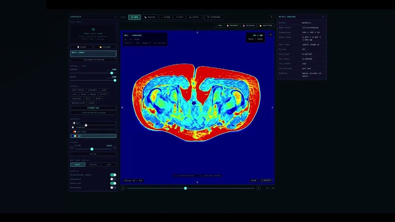 Scan Instant gallery image