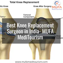 Knee Prosthesis gallery image