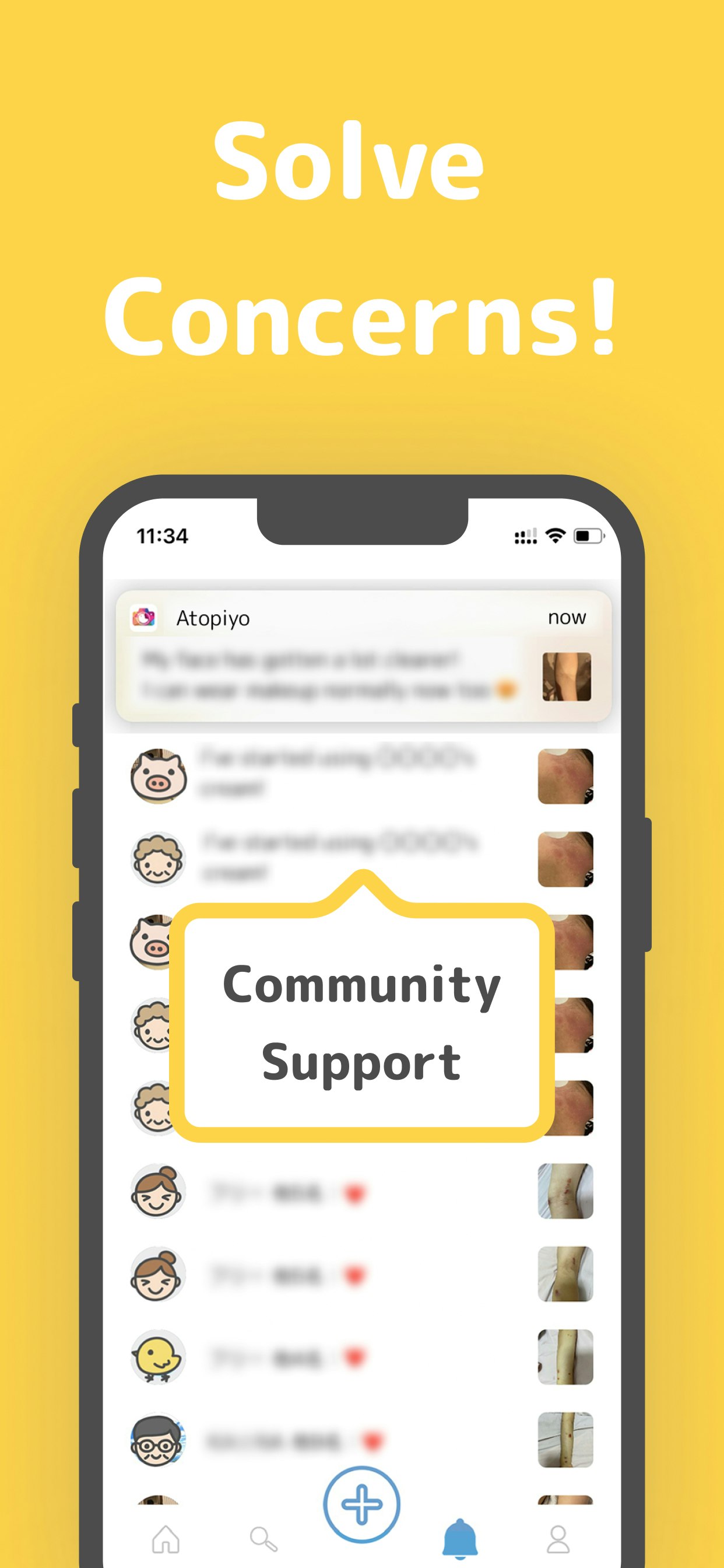 Visual Eczema Care - AtOPiyo - L'app Eczema numero 1 del Giappone - 29 K utenti, ora avviati negli Stati Uniti. media 4
