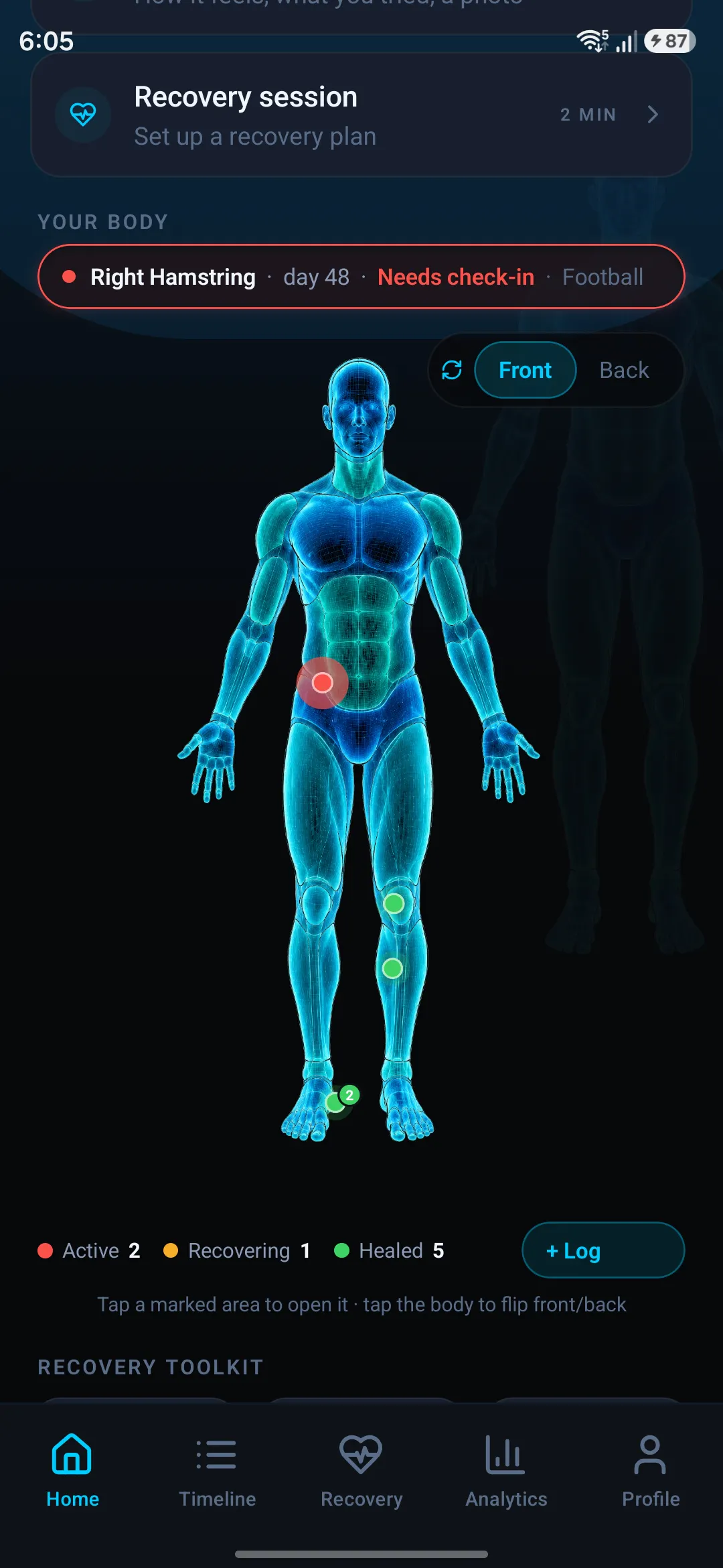 InjuryLog gallery image