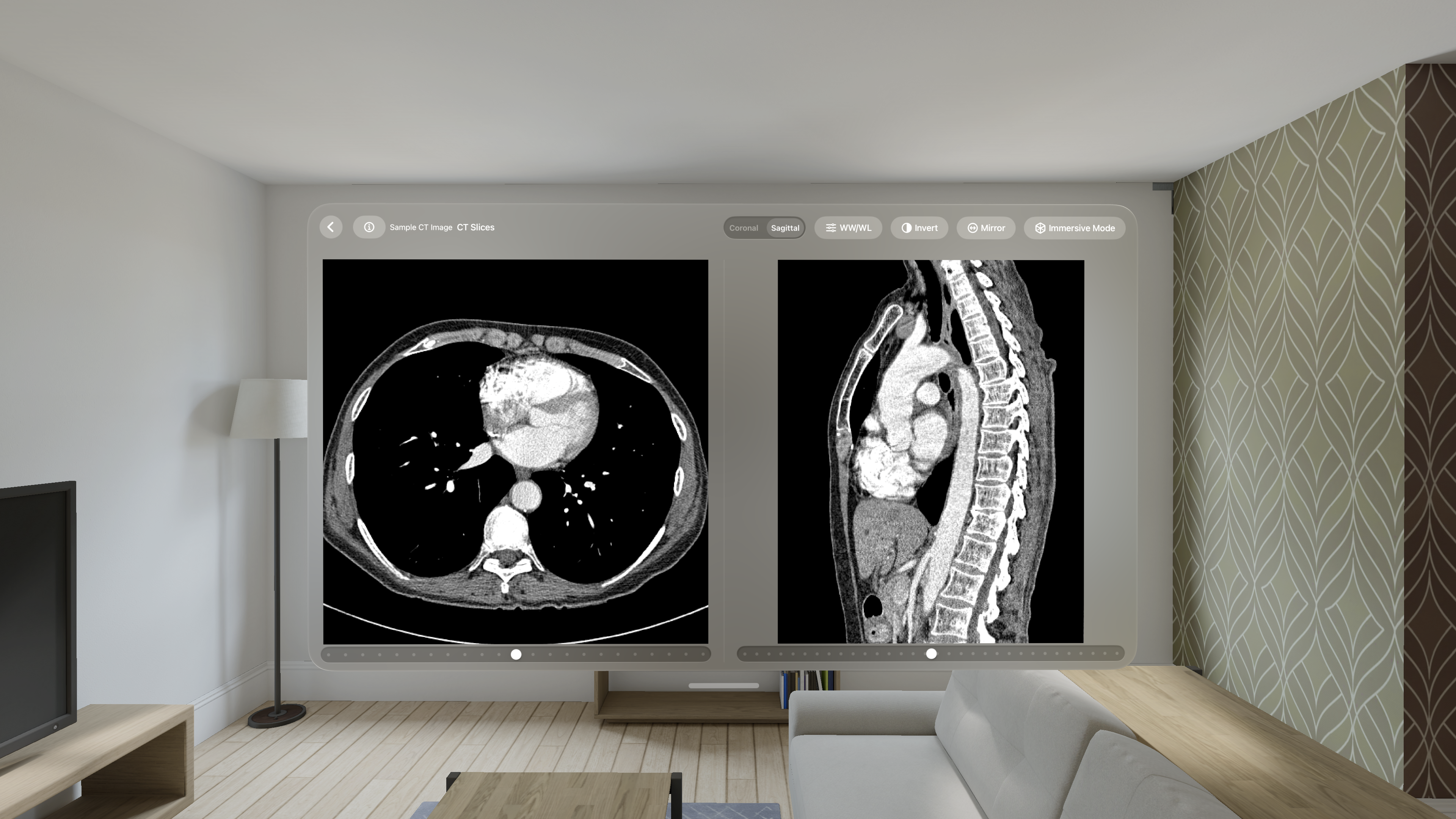 VoxelVision - DICOM Viewer gallery image