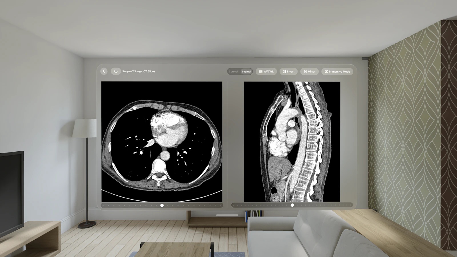 VoxelVision - DICOM Viewer screenshot 5